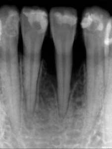 periodontal therapy service