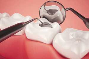 restorative dentistry, how to
