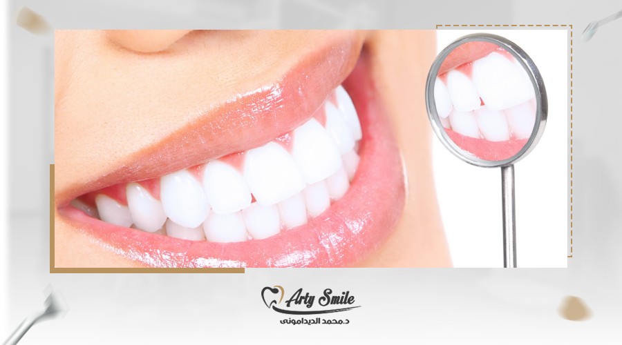 الحشوات التجميلية لسد فراغات الاسنان بدون تقويم
