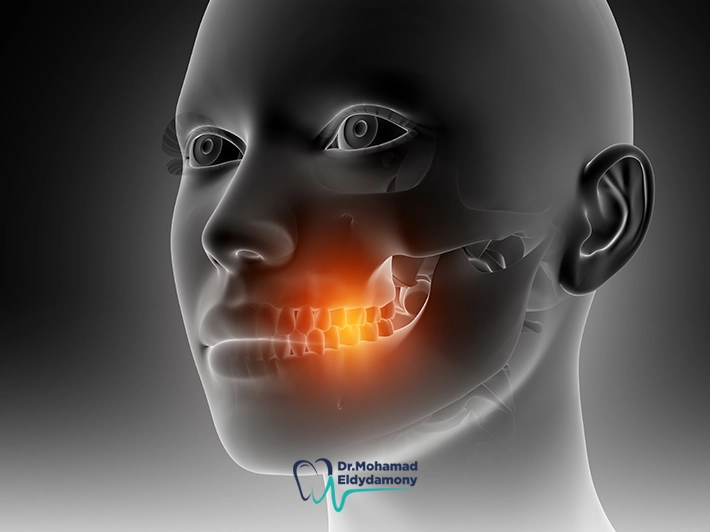 تجربتي مع زراعة عظم الفك