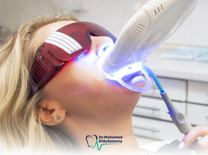 جلسات تبييض الاسنان بالليزر