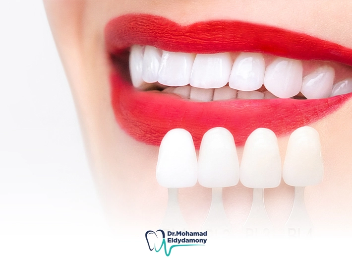 سعر الفينير في مصر