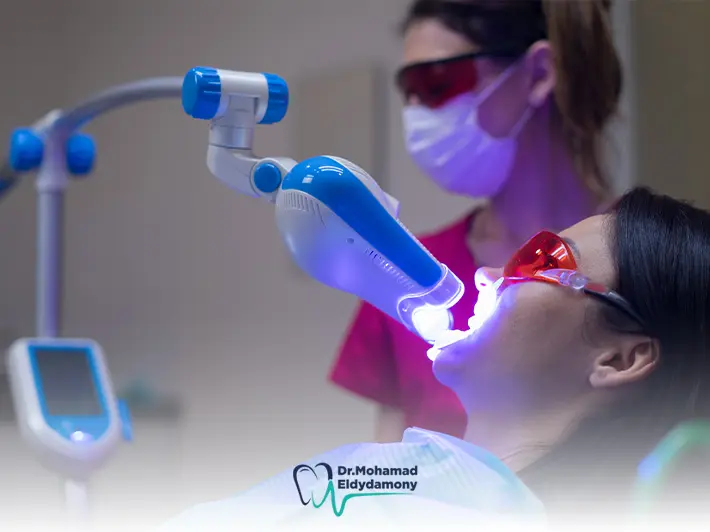 اضرار تبييض الاسنان بالليزر