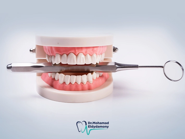 طقم اسنان متحرك