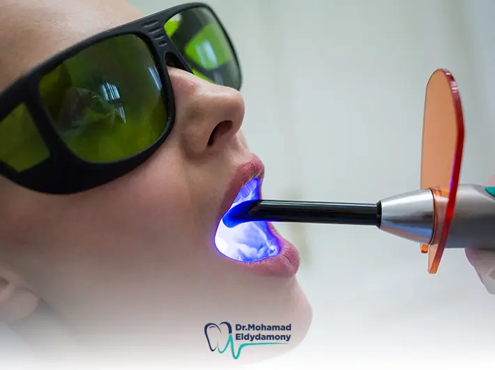 عيوب حشو الليزر