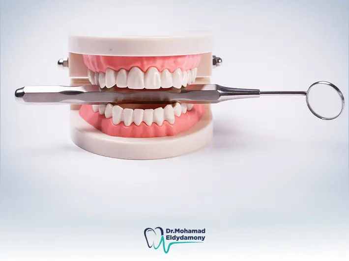 مشاكل تركيبات الاسنان الثابتة