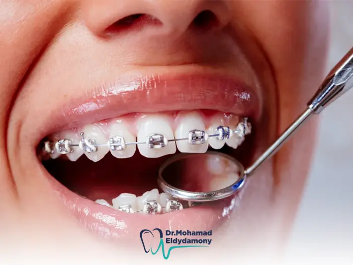 افضل دكتور تقويم اسنان في مصر