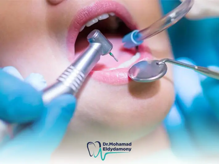 افضل دكتور جراحة اسنان