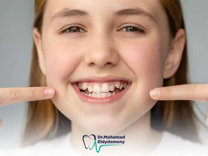 علاج الاسنان المعوجة بدون تقويم